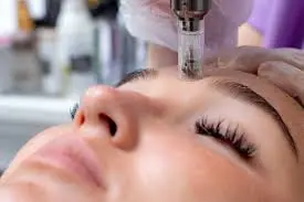 Unlocking Youthful Skin The Wonders of Microneedling Pen Technology