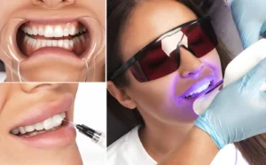 4 Popular Cosmetic Dental Treatments That Deliver Quick Results