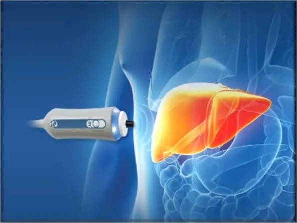 Understanding Liver Elastography A Non-Invasive Approach to Liver Health